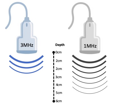 Representation of the 1 and 3MHz depth tissue penetration